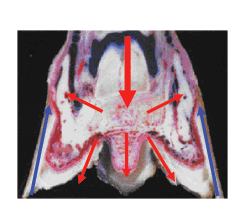 laminitis