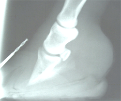 laminitis